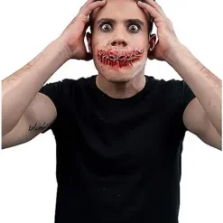 Sewn Mouth Appliance